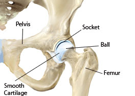 Hip Replacement