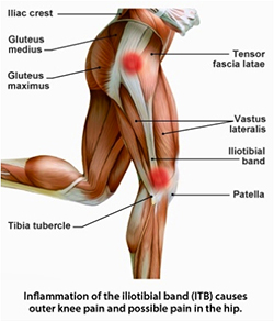 What is hip arthroscopy and is it right for me?