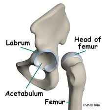 What is hip arthroscopy and is it right for me?