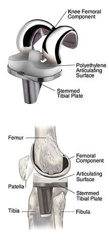 Recovery Knee Images